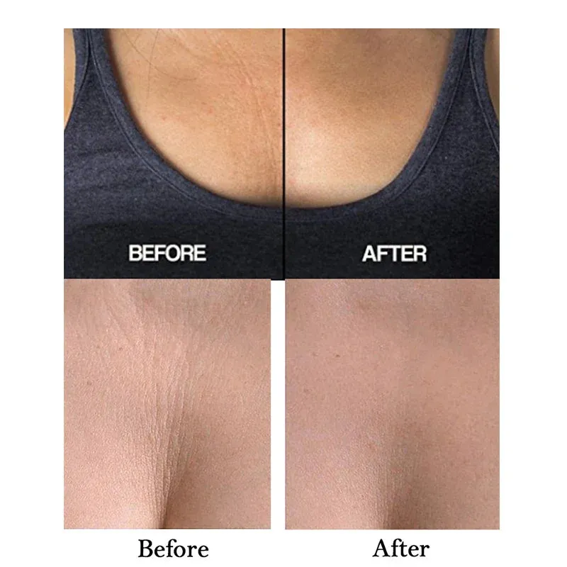 Reusable Chest Lift Patch Self-adhesive Chest Neck Pad Silicone Anti-Aging Wrinkle Remover Pad